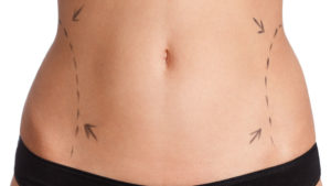 The Body Firm | FAQs about Body Contouring in Singapore Post-Pregnancy