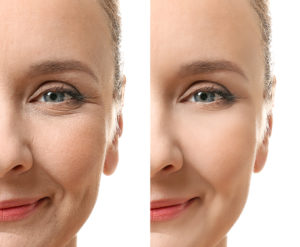 Wrinkle-free
