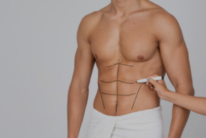 The Body Firm | Body Shaping for Men: Achieve Your Desired Physique with Targeted Treatments